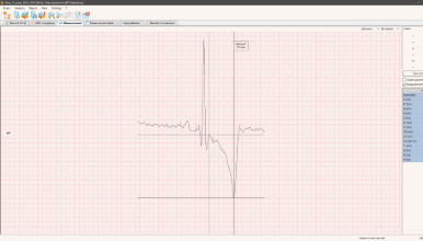 ECG of the dog. Measurement of QRS wave