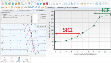 Шаблон стандартной методики оценки короткоинтервального интракортикального ингибирования (SICI) и фасилитации (ICF)