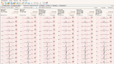 Анализ усредненных кардиокомплексов