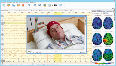 Video EEG monitoring