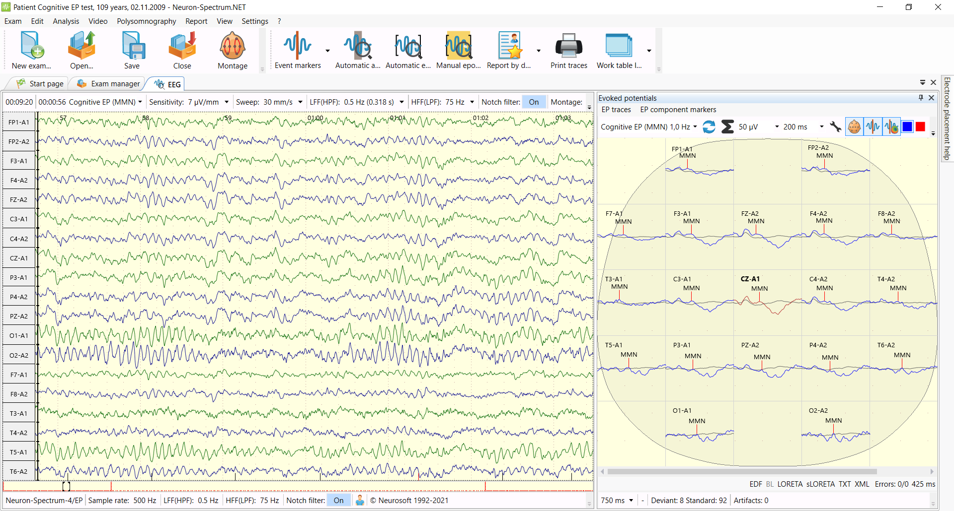 Neuron-Spectrum-LEP