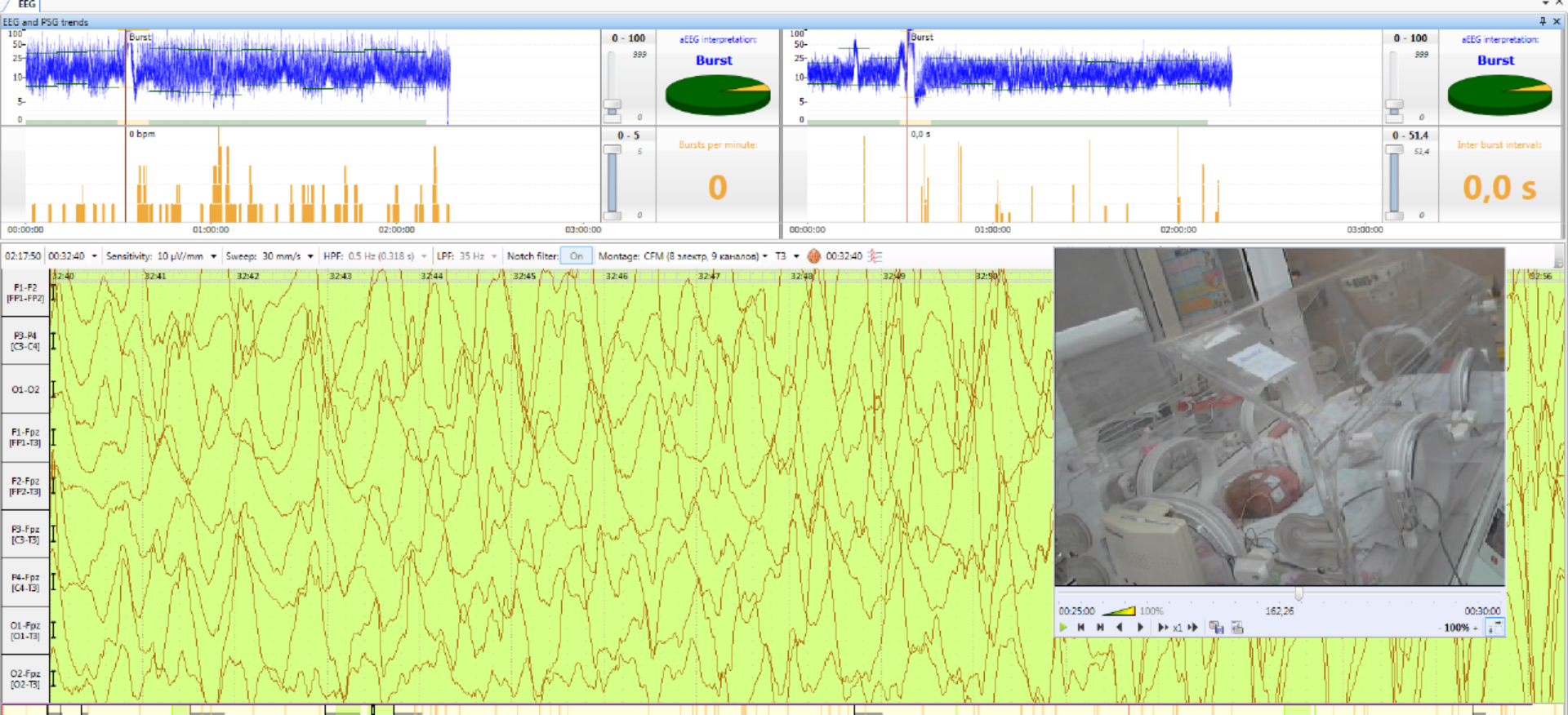 Neuron-Spectrum-CFM Neuron-Spectrum-CFM