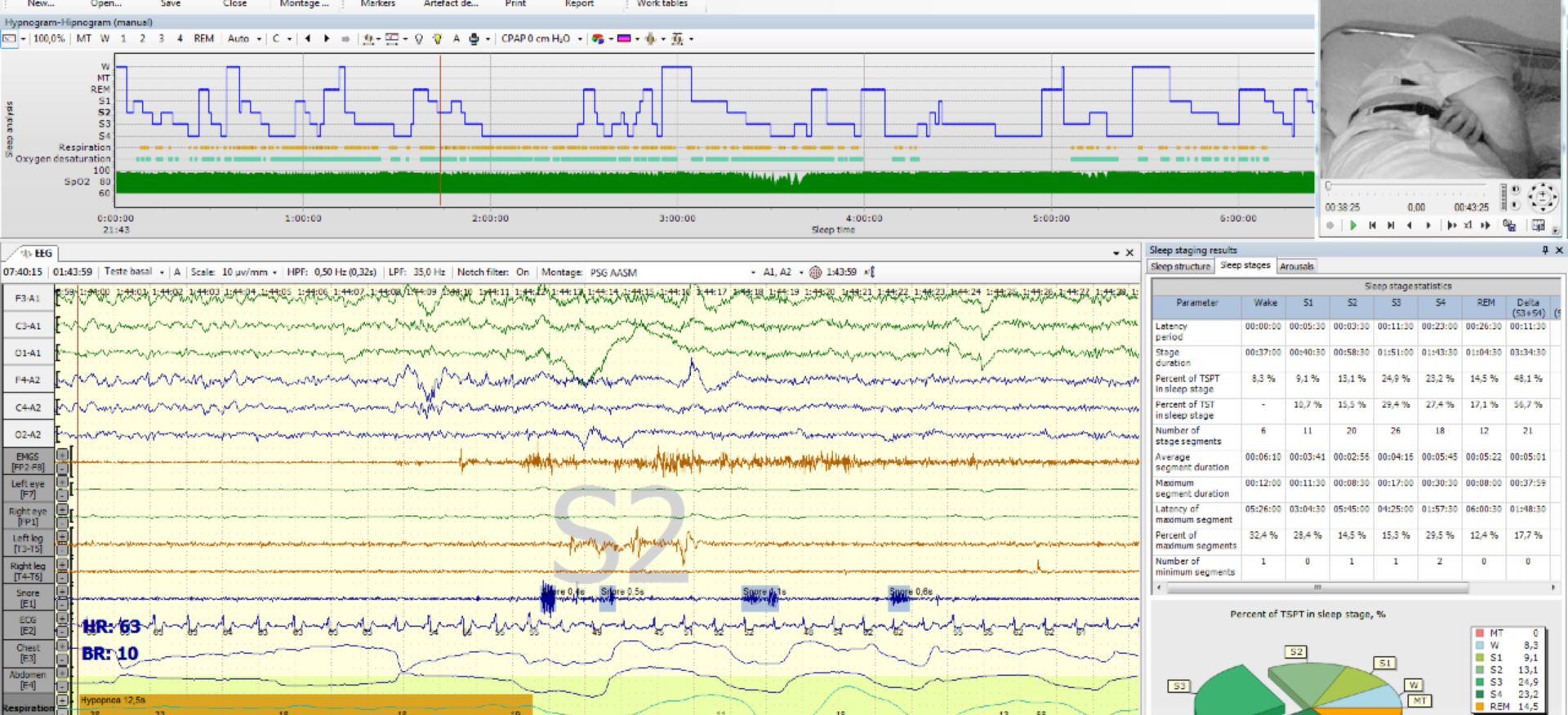 Neuron-Spectrum-PSG Neuron-Spectrum-PSG