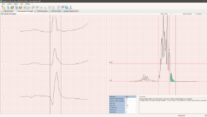 Poly-Spectrum-VLP