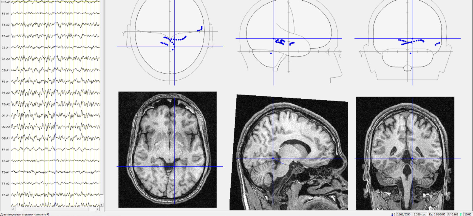 BrainLoc 6.0 BrainLoc 6.0