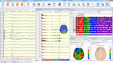Построение графиков результатов спектрального и когерентного анализа ЭЭГ