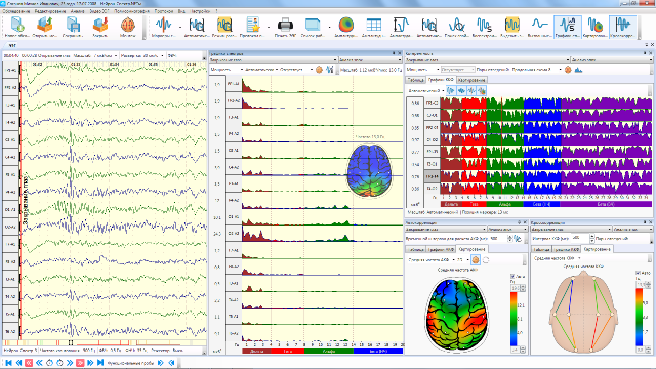 Построение графиков результатов спектрального и когерентного анализа ЭЭГ