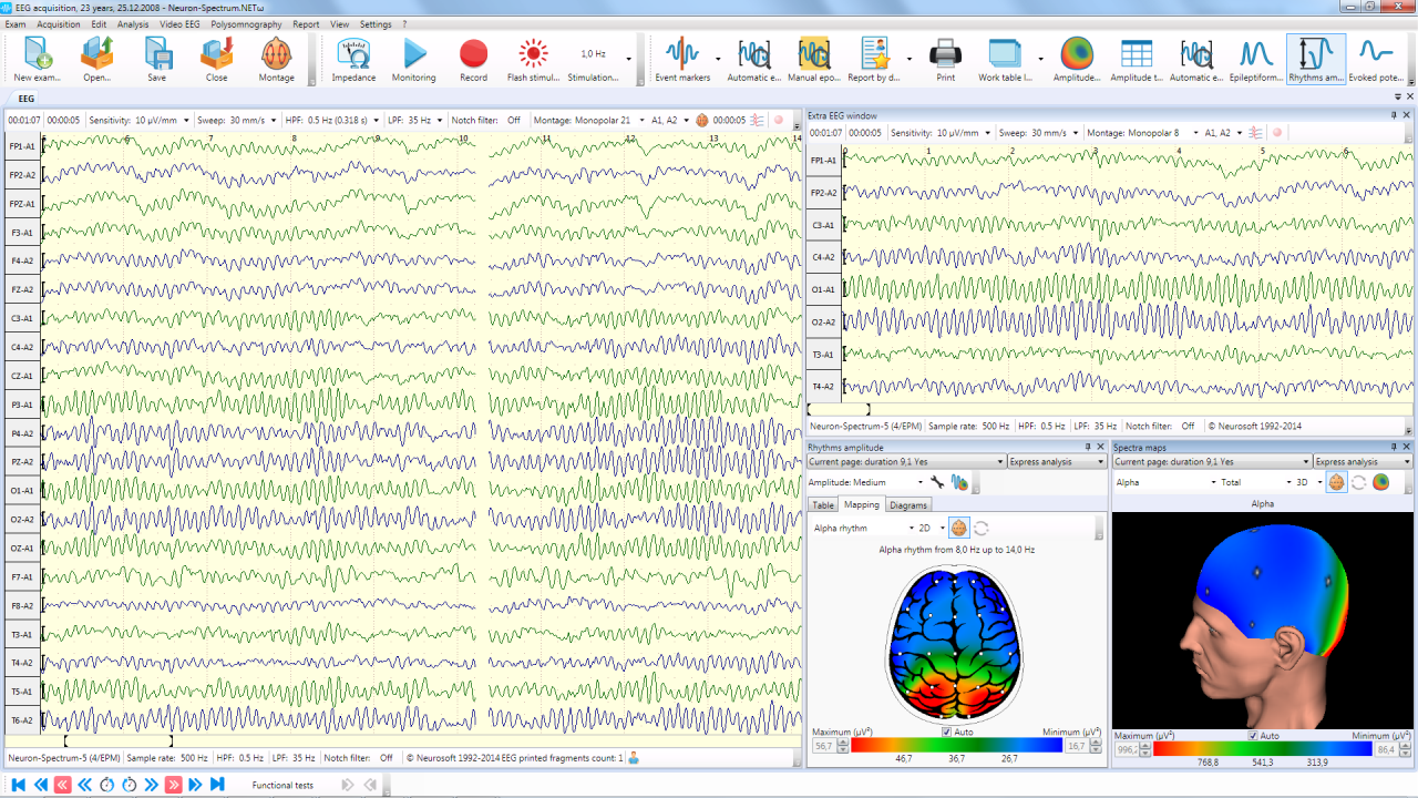 EEG acquisition