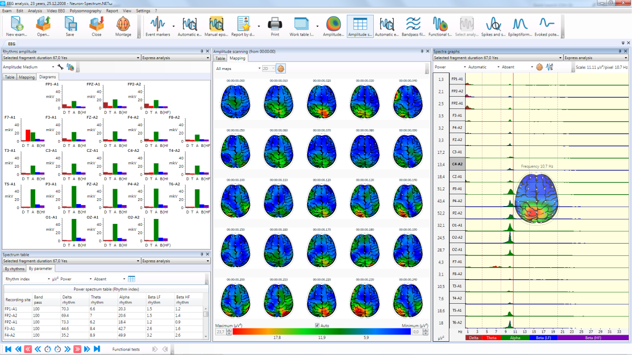 Brain mapping and bar charts of EEG analysis results