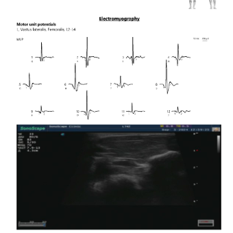 Report with ultrasound data