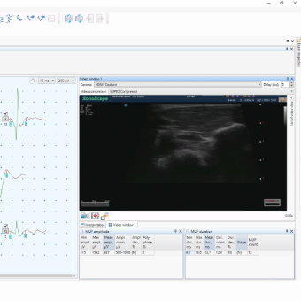 Exam window with EMG curves and ultrasound image