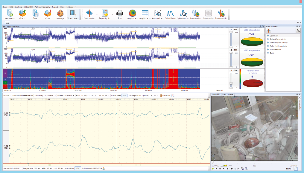 Software and equipment