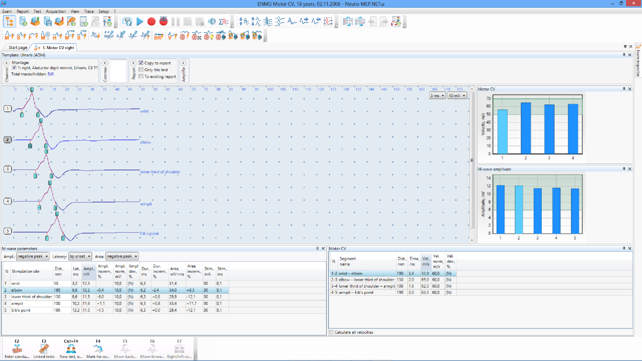 Software and equipment
