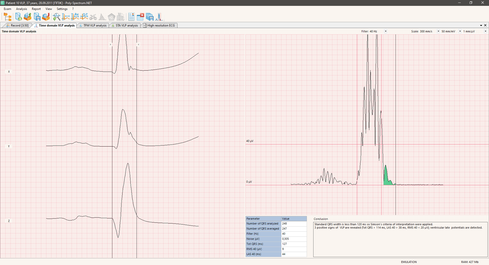 Poly-Spectrum-VLP