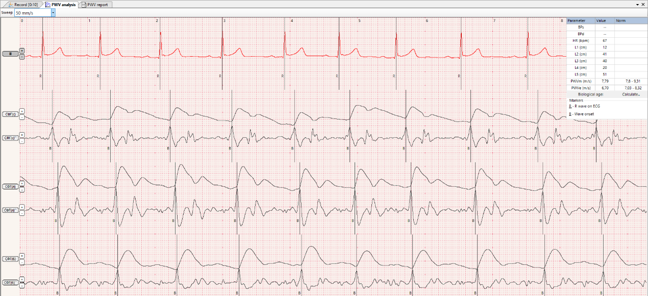 Poly-Spectrum-PWV