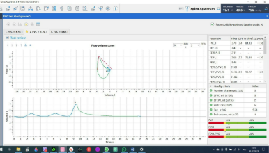 FVC test