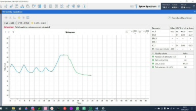 VC test