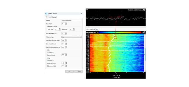 Practical aspects of using DSA spectral analysis in Neuro-IOM.NET software