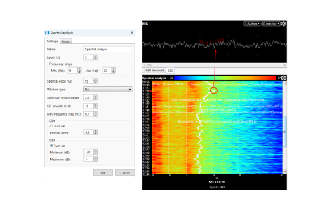 Practical aspects of using DSA spectral analysis in Neuro-IOM.NET software