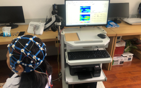 EEG without using gels and pastes!