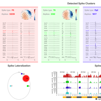 Neuron-Spectrum.NET integration with Epilog Preop