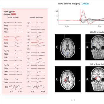 Neuron-Spectrum.NET integration with Epilog Preop