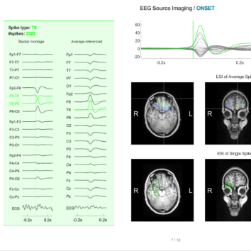 Neuron-Spectrum.NET integration with Epilog Preop