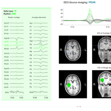 Neuron-Spectrum.NET integration with Epilog Preop