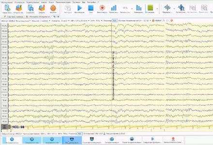 «ОБРАЗ»: открытая база размеченных ЭЭГ-записей для развития искусственного интеллекта и медицины