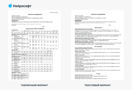 В ПО «Нейро-МВП.NET» теперь доступен текстовый протокол обследования, совместимый по формату с большинством МИС России!