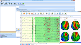 Towards Standardized EEG Reports