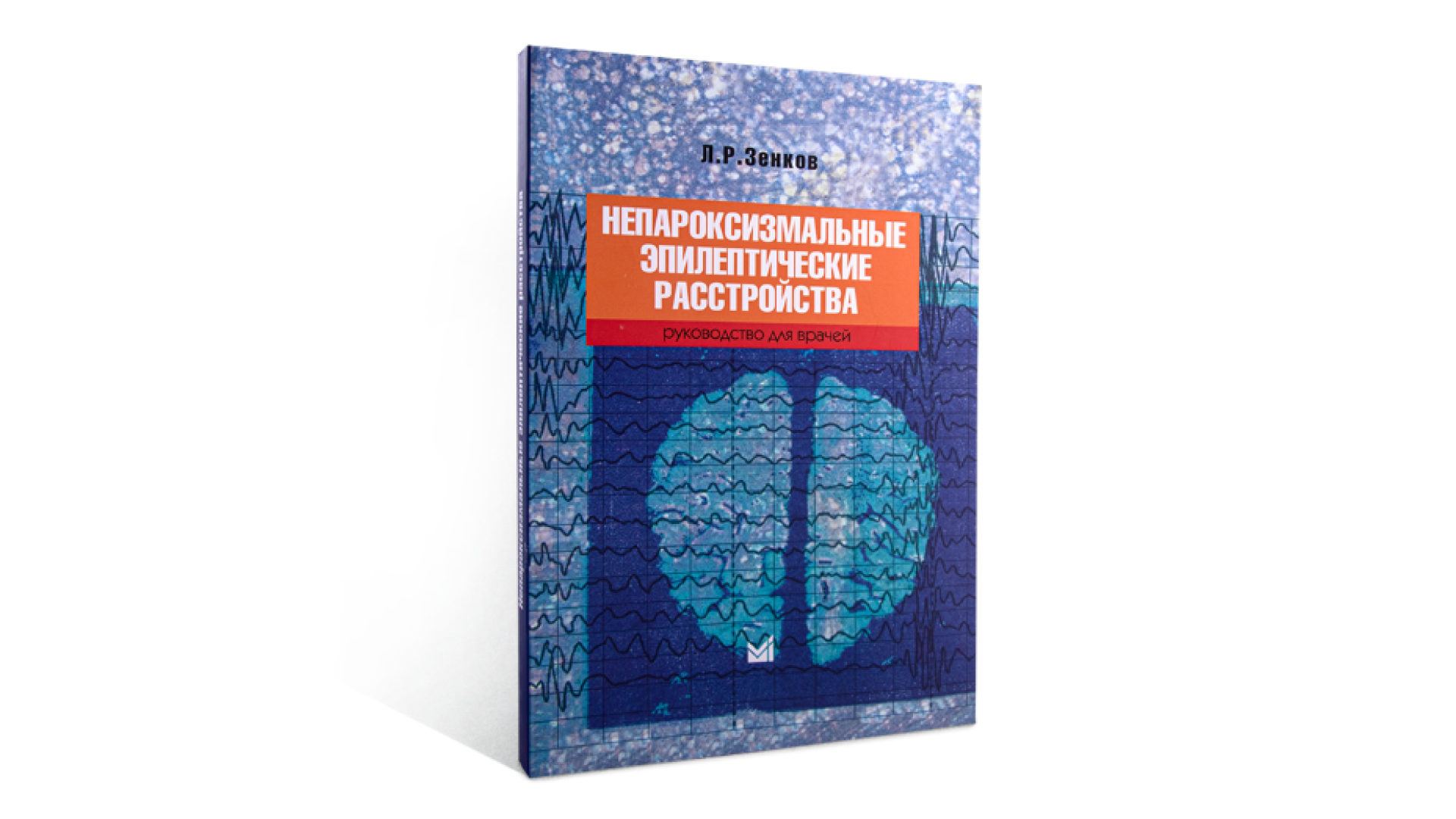 Непароксизмальные эпилептические расстройства